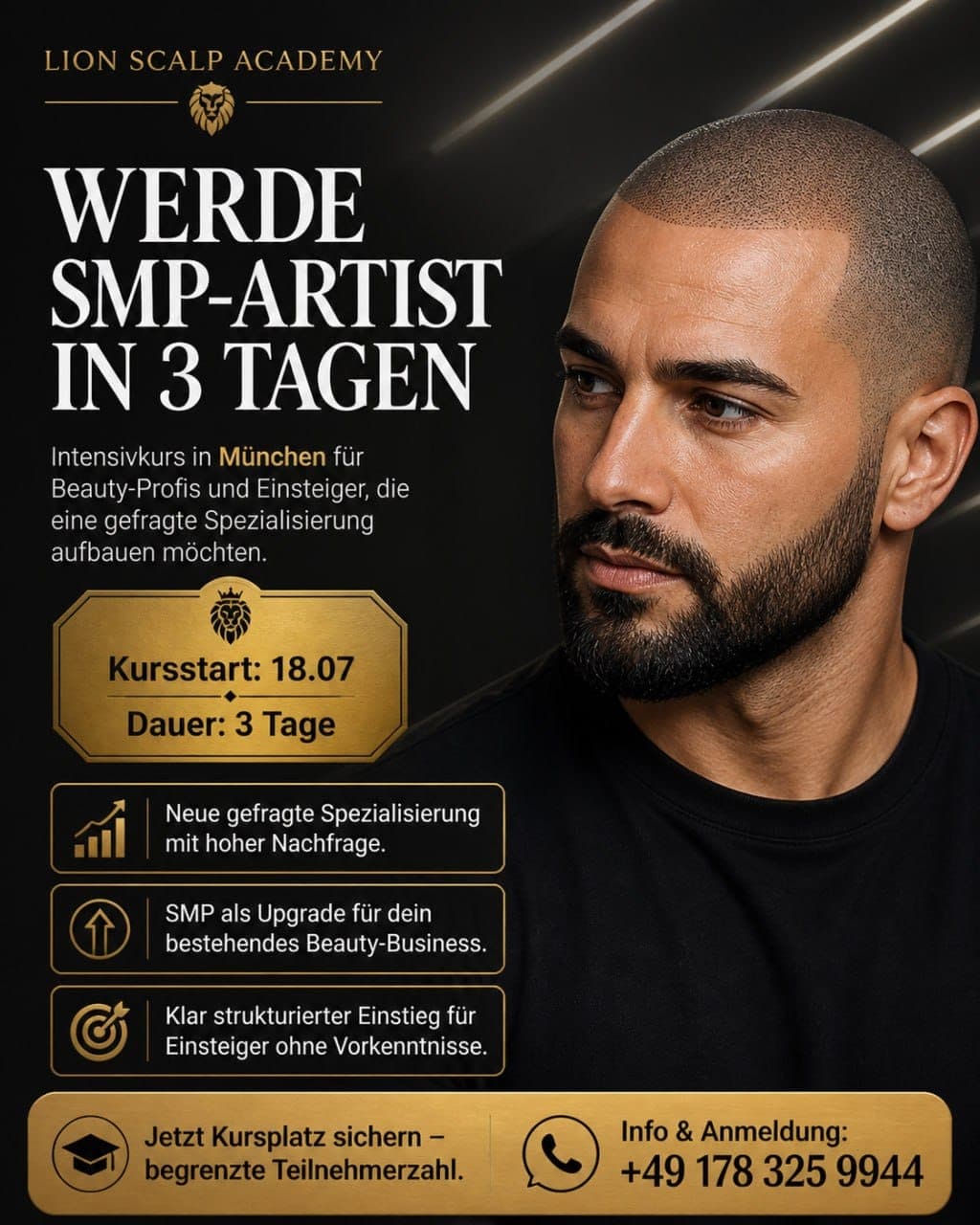 Professionelle Haarpigmentierung in München bei Lion Scalp SMP ist die ideale Lösung bei Haarausfall, lichtem Haar oder Narben. Durch feinste Pigmentpunkte entsteht der Eindruck von mehr Haardichte und einer klar definierten Haarlinie. lionscalp-smp.com