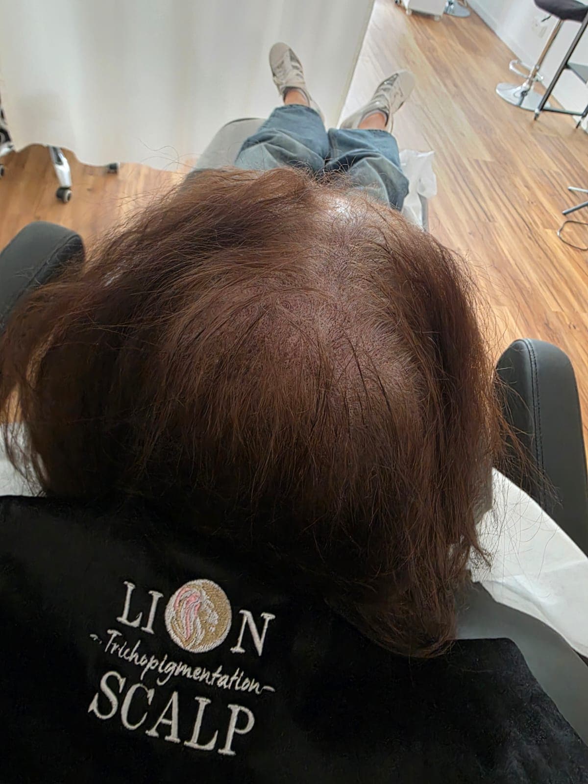 Professionelle Haarpigmentierung in München bei Lion Scalp SMP ist die ideale Lösung bei Haarausfall, lichtem Haar oder Narben. Durch feinste Pigmentpunkte entsteht der Eindruck von mehr Haardichte und einer klar definierten Haarlinie. lionscalp-smp.com